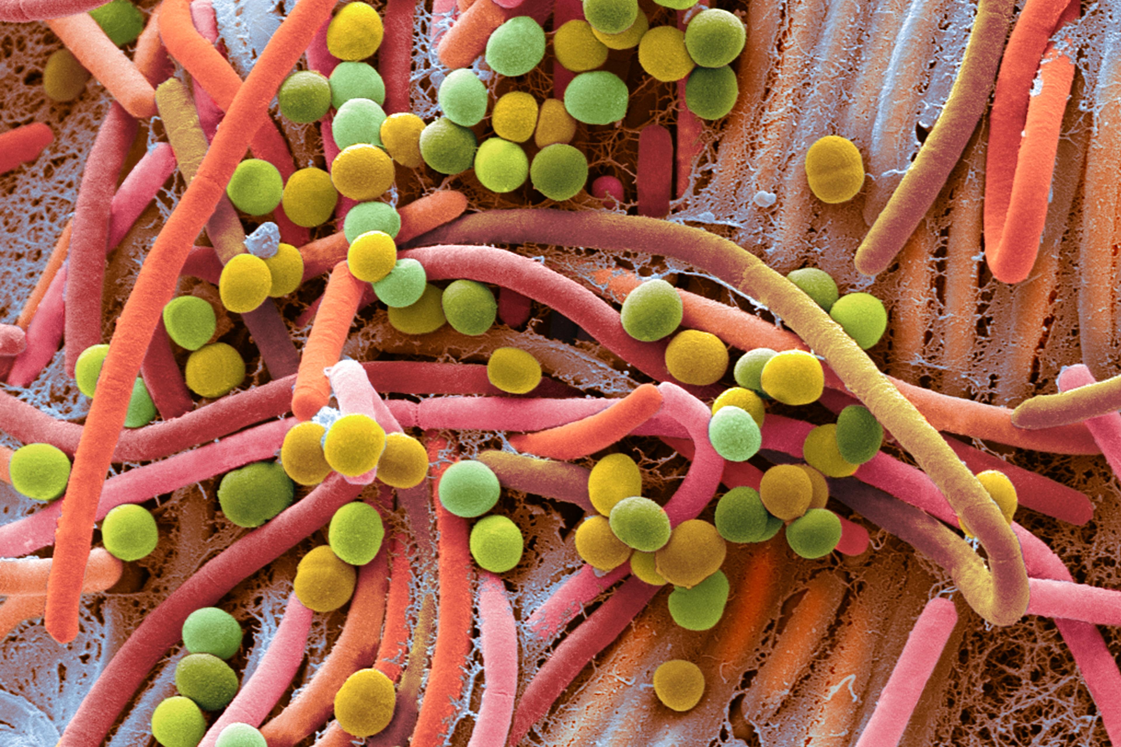 Coloured electron microscope image of bacteria and fungi; round green/yellow cells and rod-shaped pink structures on a textured surface.